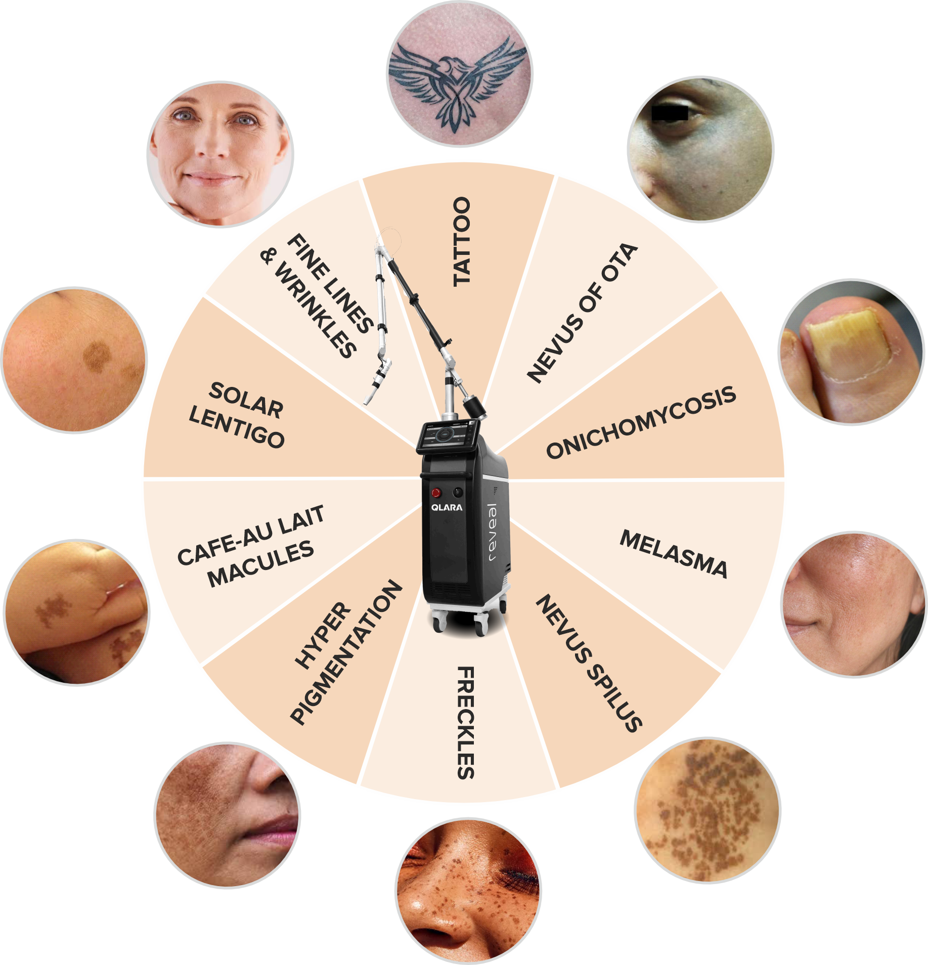 Qlara Results